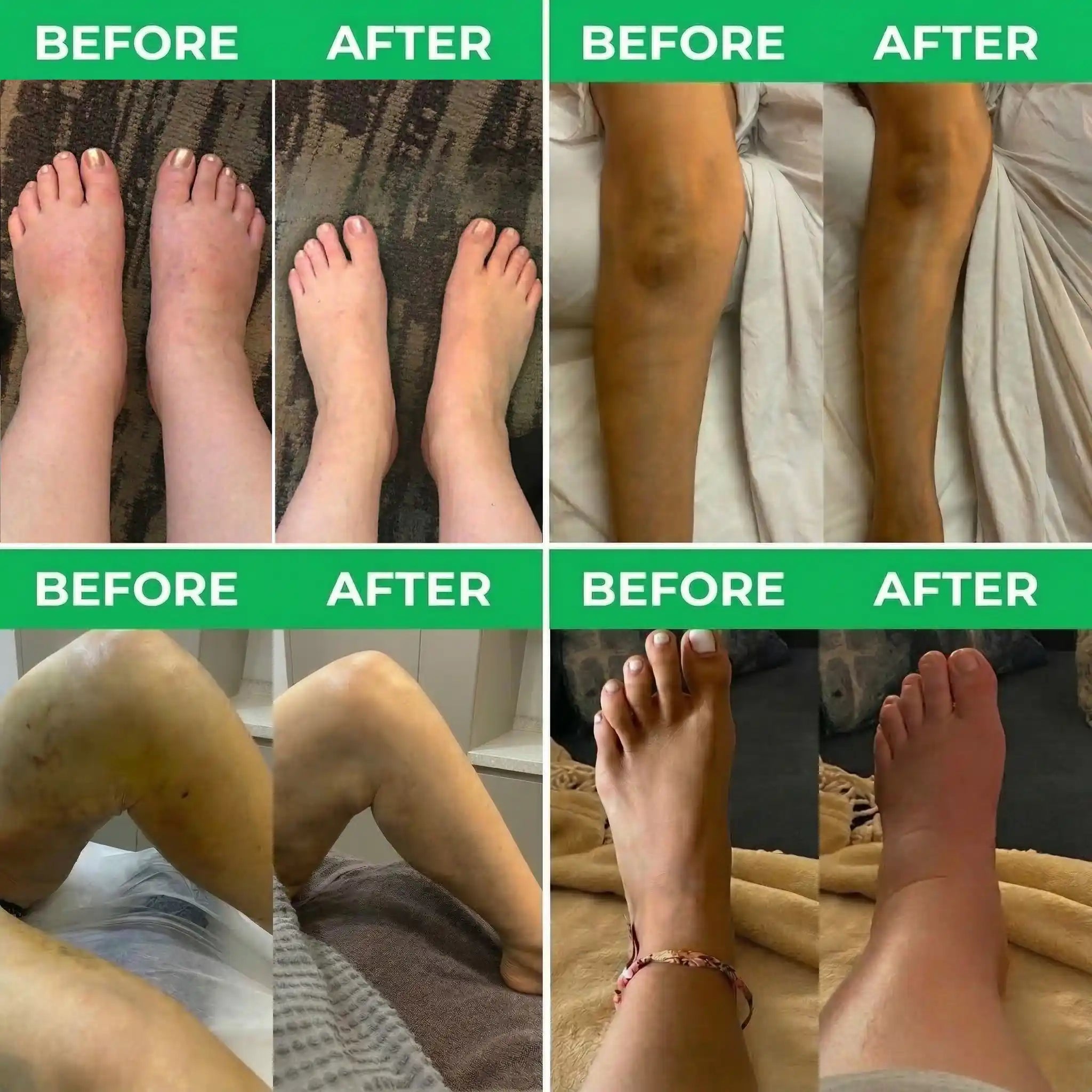 -Recovie™ 3-in-1 Leg Massager